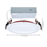 Nuvo Lighting S11867R1 6in Fire-Rated LED Downlight | Step Baffle White Finish | Kitchen & Living Room Recessed | Model S11867R1